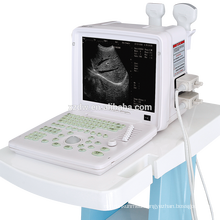 Small medical ultrasound scanner machine with cheap price & portable ultrasonic equipment for pregnancy DW-360